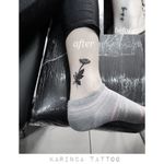 Cover Up 🌼 Instagram: @karincatattoo #daisy #tattoo #tattoos #tattoodesign #tattooartist #tattooer #tattoostudio #tattoolove #tattooart #istanbul #turkey #dövme #dövmeci #design #girl #woman #tattedup #inked #cover #coverup