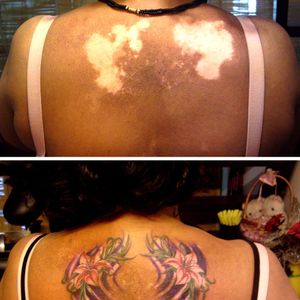 Tatuagem feita em cima de manchas de Vitiligo. #vitiligo #saude #dermatologia #informação #dermatologiaetatuagem