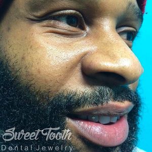 Dental jewelry by Sweet Tooth #Dental #Tooth #Piercing #BodyModification #SweetTooth