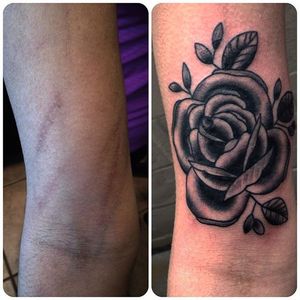 #scar #tattooedscar #brianfinn #rose