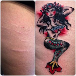 #scars #tattooedscar #brianfinn #mermaid