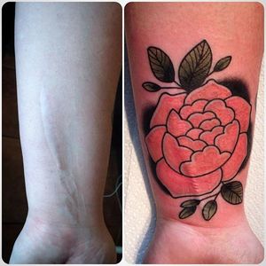 #scar #tattooedscar #brianfinn #rose