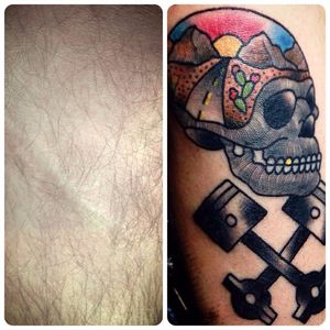 #scar #tattooedscar #brianfinn #skull