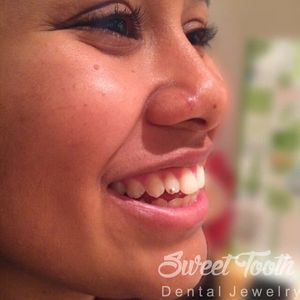 Dental Jewelry by Sweet Tooth #Dental #Tooth #Piercing #BodyModification #SweetTooth #DentalJewelry