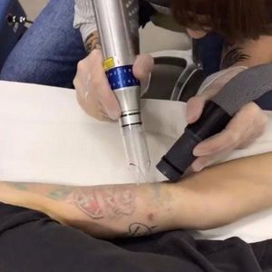 Jessica Origliasso having her tattoos removed. #RubyRose #JessicaOrigliasso #TheVeronicas #TattooRemoval