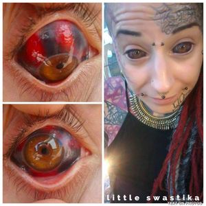 Eyeball tattooing #LittleSwastika #bodymodification #eyeballtattoos