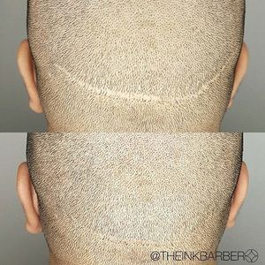 Scalp micro-pigmentation by Shannon Liddell (via IG-theinkbarber) #scalpmicropigmentation #cosmetictattoo #hairloss #ShannonLiddell