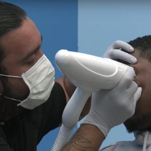 Adrian Torres removing a man's teardrop tattoos. #AdrianTorres #gangtattoos #laserremoval #philanthropy