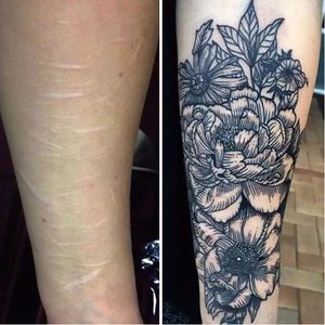 Floral scar tattoo cover up by Whitney Develle. #scar #selfharm #coverup #floral #flower #linework