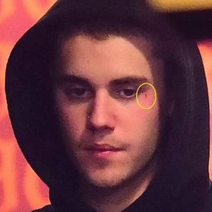 A not at all creepy photo of Justin's new face tattoo via US Magazine #JustinBieber #face #celebrity