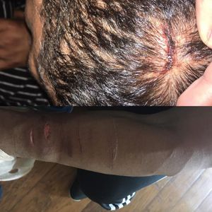 Del Rio's cuts on his head and arm. #AlbertoDelRio #AlbertoElPatron #WWE #Cuts