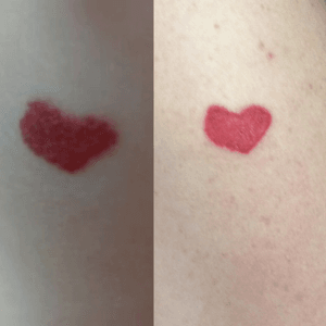 My daughters birth mark (on the left) and got it tattooed (on right)