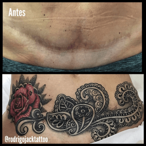 Tattoo cover estrias ➡️patrocinio electricink➡️snapchat: Rodrigo_jack ➡️zap :(05521)99808-8687 