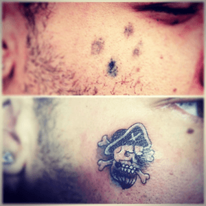 #pirate#headtattoo#face#underground#tattooist#BlackworkTattoos#inkedboy#cover#coverup