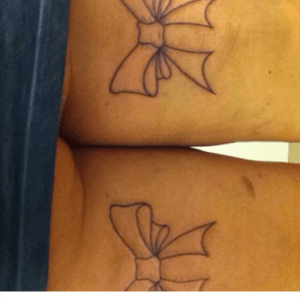 First ever tattoo's! #bows 