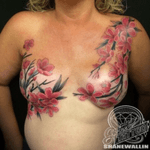 #breastcancer #breastcancerawareness #pinkribbonwarrior #mastectomy 