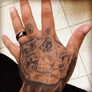 A copy of my cat scan from my car crash on my hand