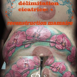 Mammal scar hidden. #scar #hide #orchide #breastcancer 