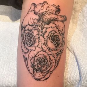 Rad anatomical rose heart 