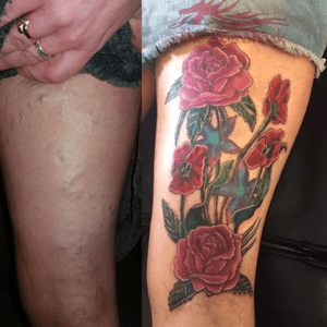 A rose design to cover skin my customer was self conscious about #redroses #coveruptattoo #theskinshack #colourtattoo 
