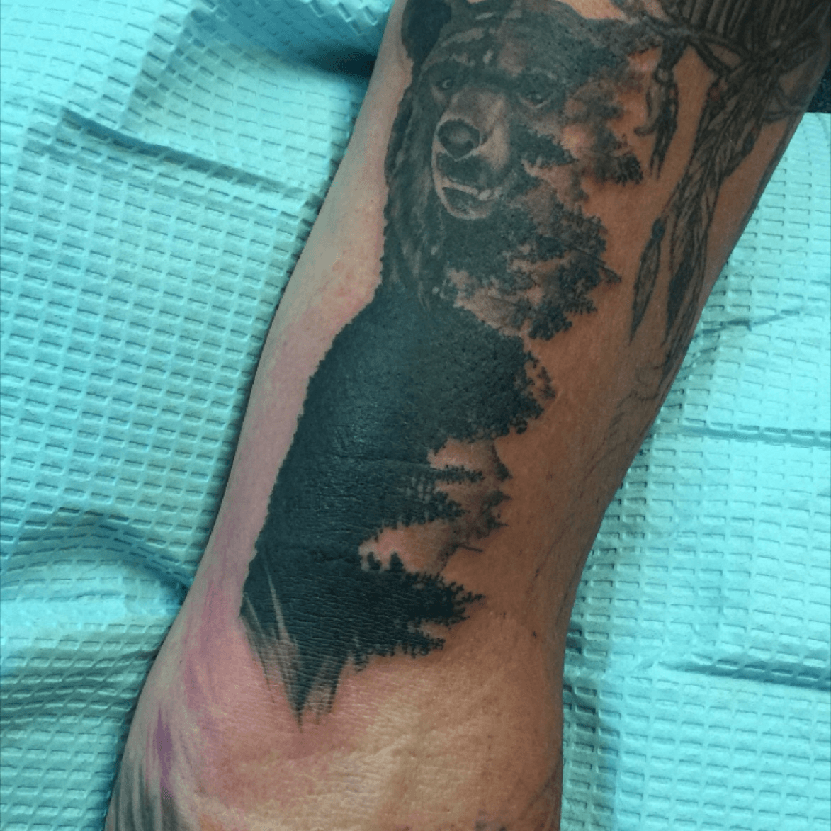 Tattoo Infection How Do You Know If Your New Ink Is Infected