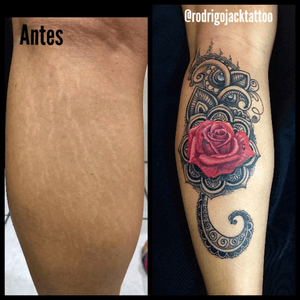 Tattoo cover estrias ➡️patrocinio:@electricink. ➡️zap: (05521)99808-8687➡️snapchat: Rodrigo_jack