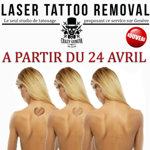 Tattoo Removal available from 24 april...,