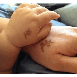 Wonderful momma got the same birthmark tattooed on her #momanddaughter #mom #baby 