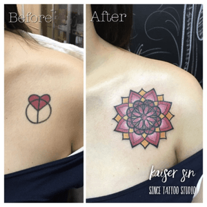 Cover up mandala by Kaiser Sin#coverup #coveruptattoo #mandala