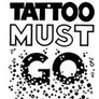 Tattoo Must Go - Colorado Springs