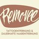 Tattooentfernung & dauerhafte Haarentfernung Frankfurt - Removee
