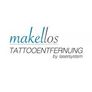 Tattooentfernung makellos by lasersystem