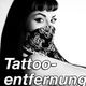 Laserwelt - Tattooentfernung
