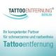 Tattooentfernung Berlin