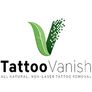 Tattoo Vanish Method