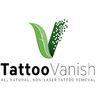 Tattoo Vanish Method