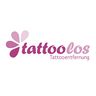 tattoolos Frankfurt - Tattooentfernung