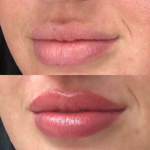 Lip liner tattoo by Claire Vuillemot #ClaireVuillemot #permanentmakeup #semipermanentmakeup #bodymod #cosmetictattoo #cosmetictattooing #liptattoo #liplinertattoo #permanentlipliner