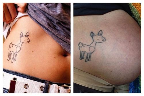 Shape and image distortion of a tattoo while pregnant
